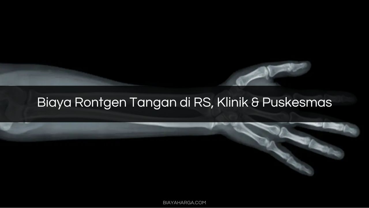 Biaya Rontgen Tangan di RS, Klinik & Puskesmas