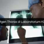 Biaya Rontgen Thorax di Laboratorium Klinik Prodia