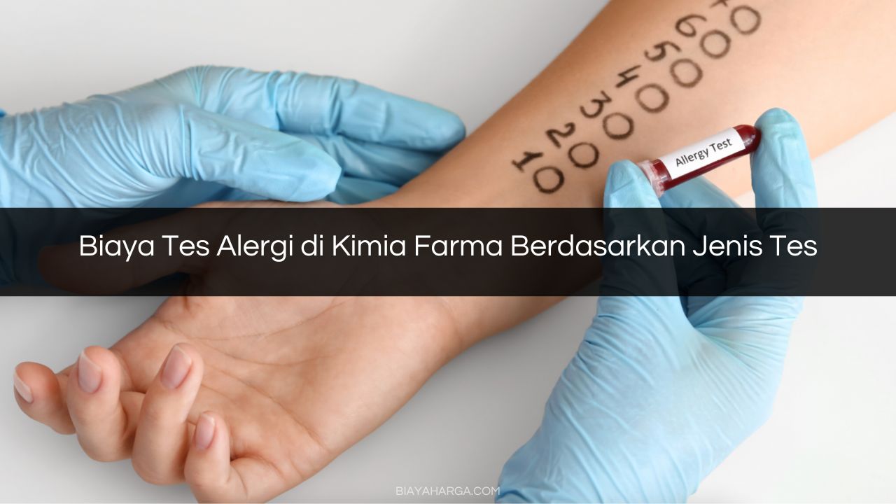 Biaya Tes Alergi di Kimia Farma Berdasarkan Jenis Tes