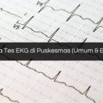 Biaya Tes EKG di Puskesmas (Umum & BPJS)