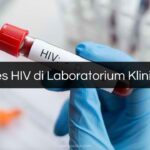 Biaya Tes HIV di Laboratorium Klinik Prodia