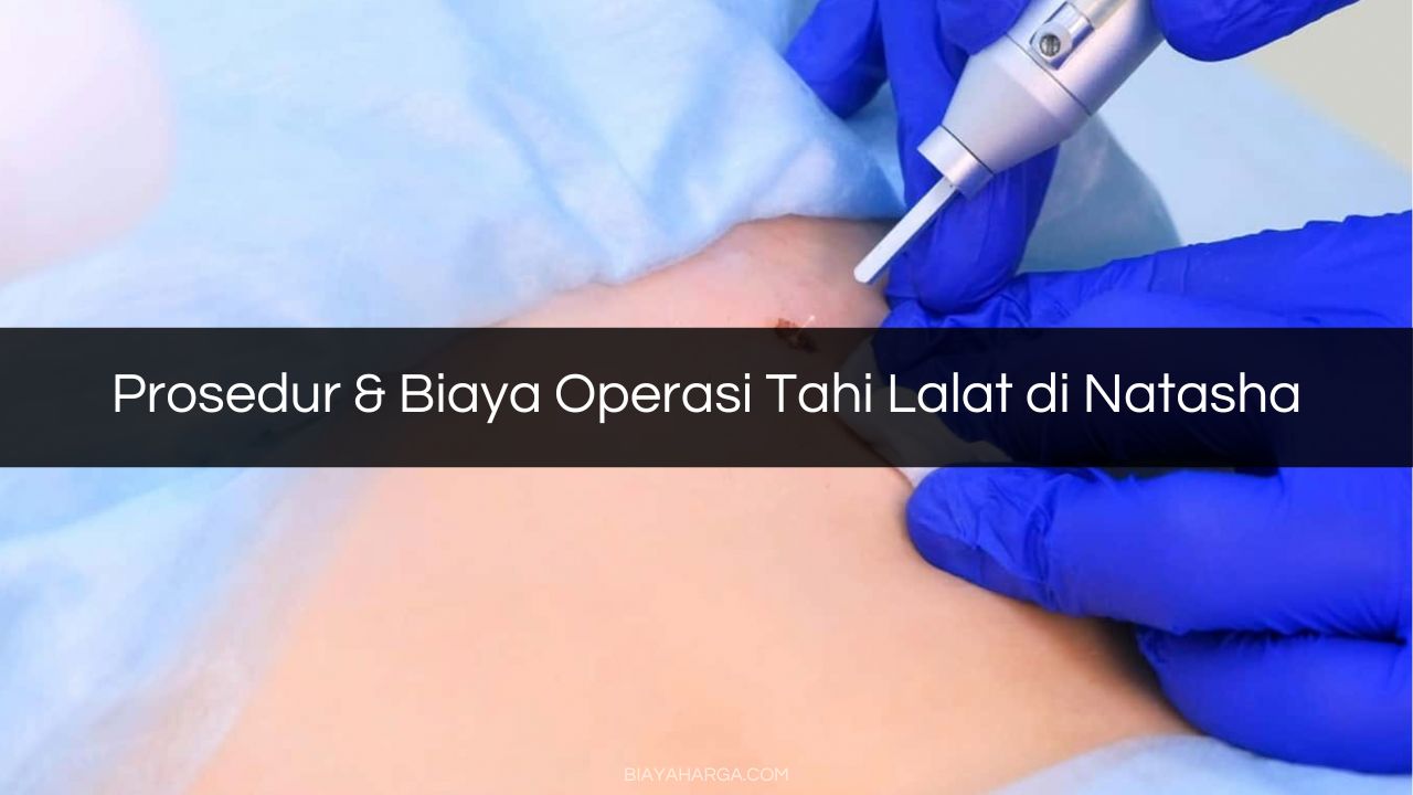 Prosedur & Biaya Operasi Tahi Lalat di Natasha