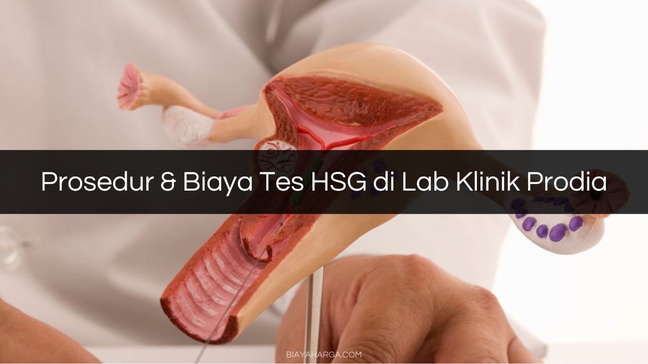 Prosedur & Biaya Tes HSG di Lab Klinik Prodia