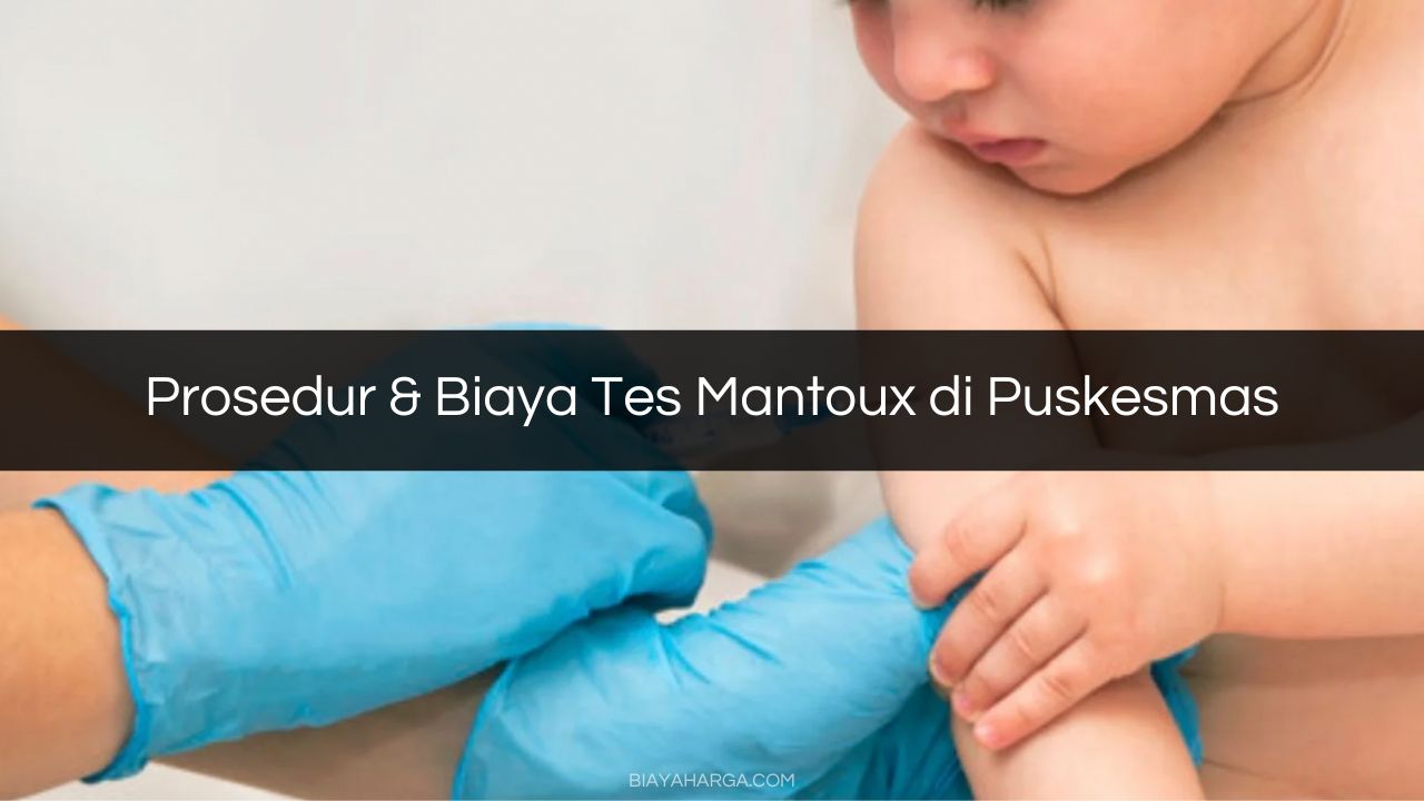 Prosedur & Biaya Tes Mantoux di Puskesmas