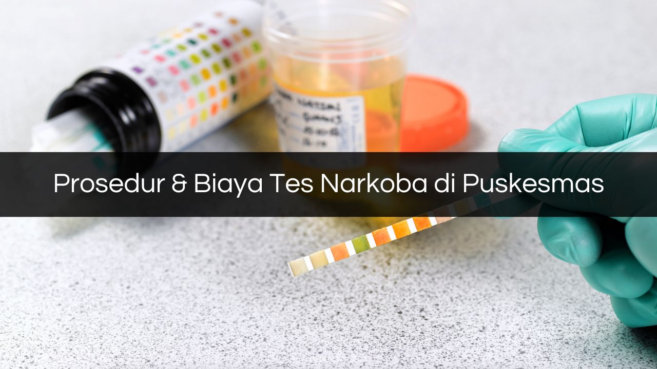 Prosedur & Biaya Tes Narkoba di Puskesmas