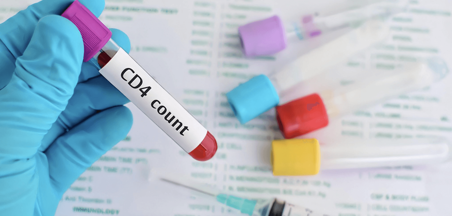 √ Biaya Tes HIV di Laboratorium Klinik Prodia 2023