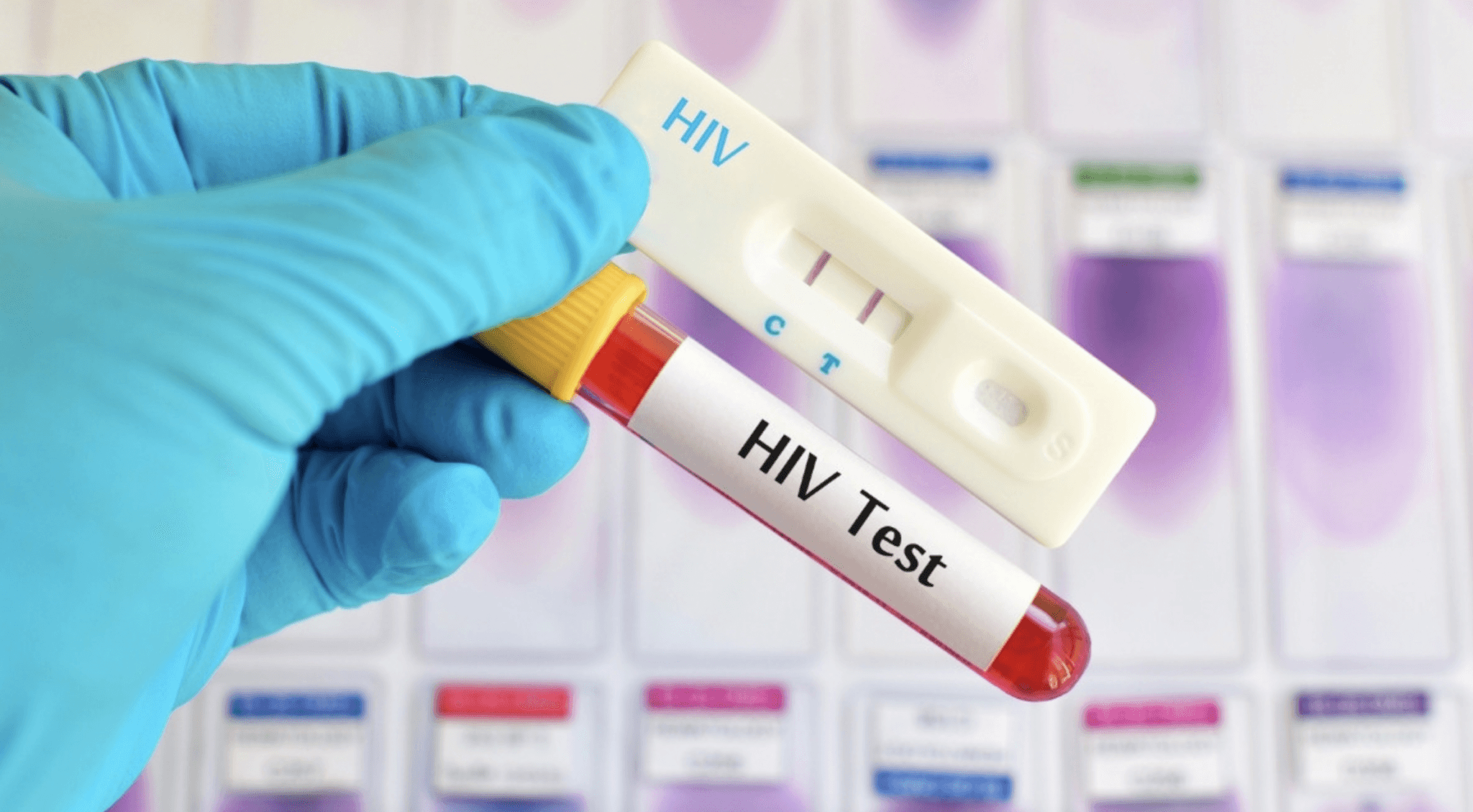 √ Biaya Tes HIV di Laboratorium Klinik Prodia 2023