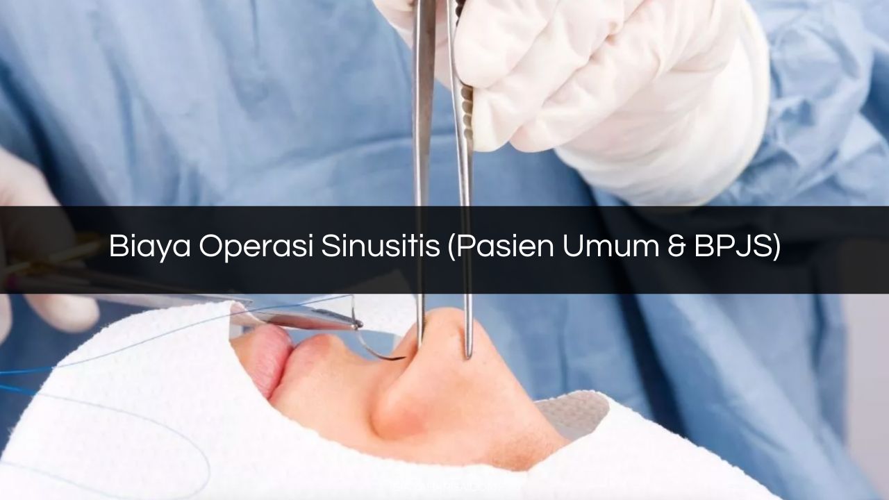 Biaya Operasi Sinusitis (Pasien Umum & BPJS)