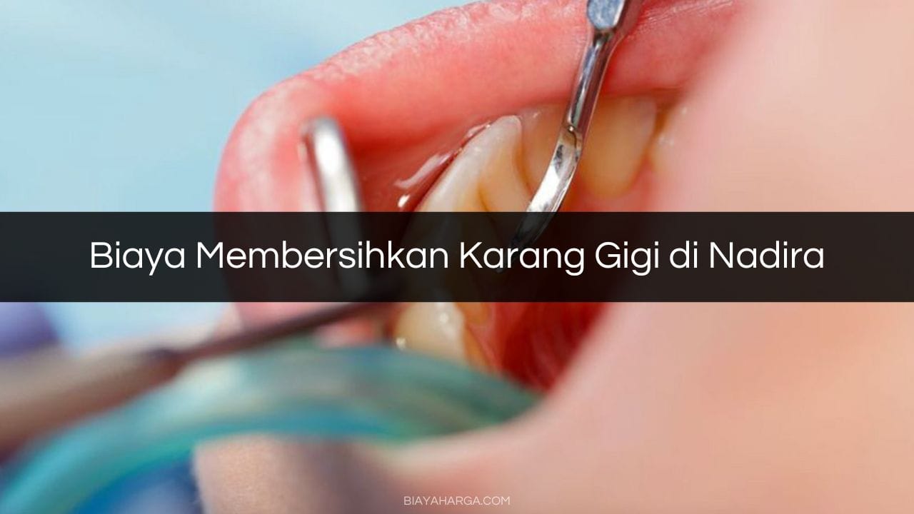 Biaya Membersihkan Karang Gigi di Nadira