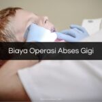 Biaya Operasi Abses Gigi