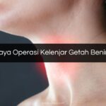 Biaya Operasi Kelenjar Getah Bening