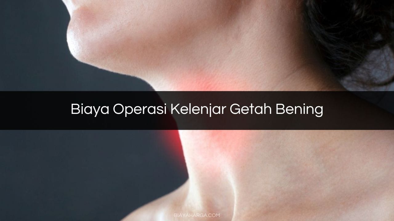 Biaya Operasi Kelenjar Getah Bening