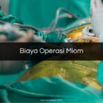 Biaya Operasi Miom