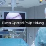 Biaya Operasi Polip Hidung