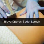 Biaya Operasi Sedot Lemak