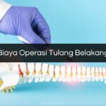 Biaya Operasi Tulang Belakang