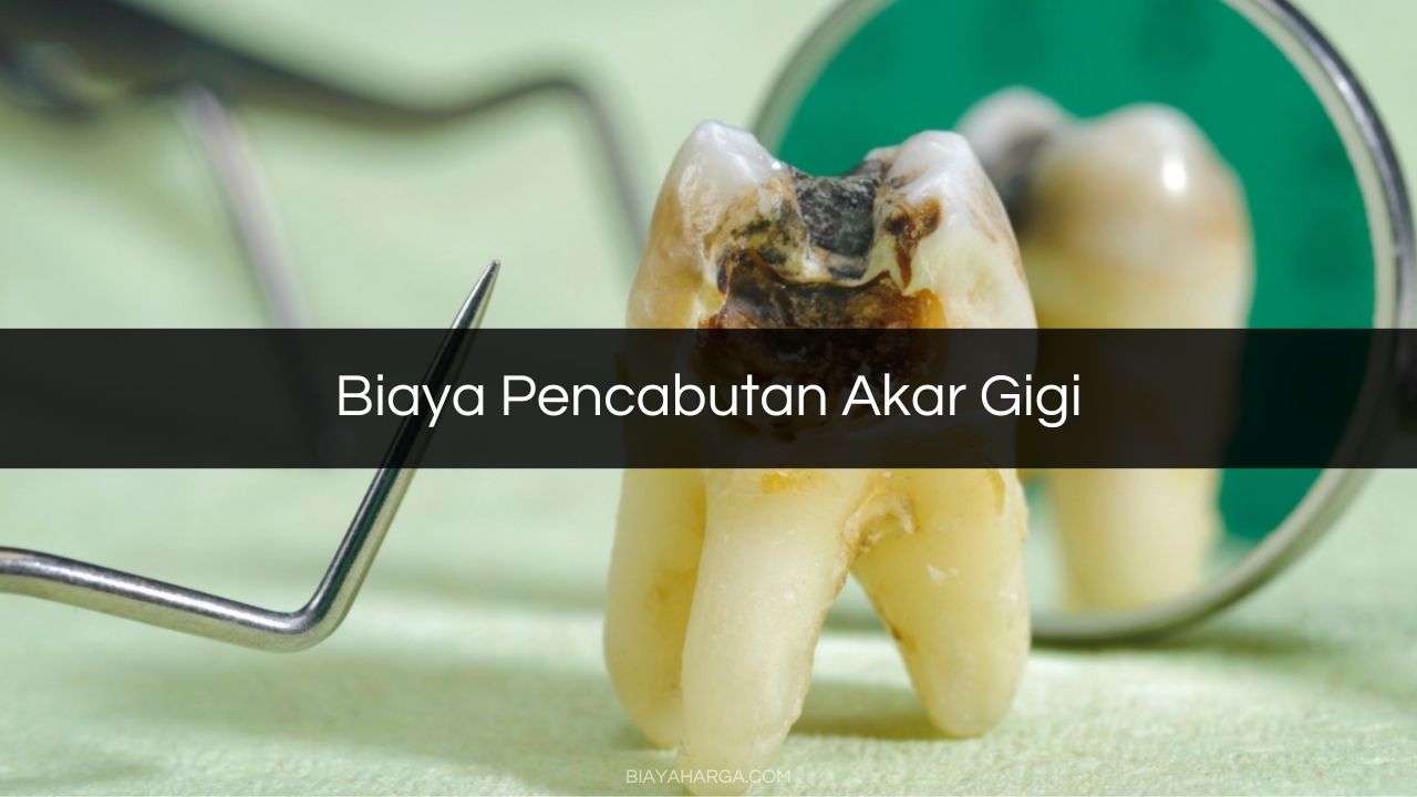 Biaya Pencabutan Akar Gigi