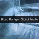 Biaya Rontgen Gigi di Prodia