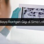 Biaya Rontgen Gigi di Sima Lab