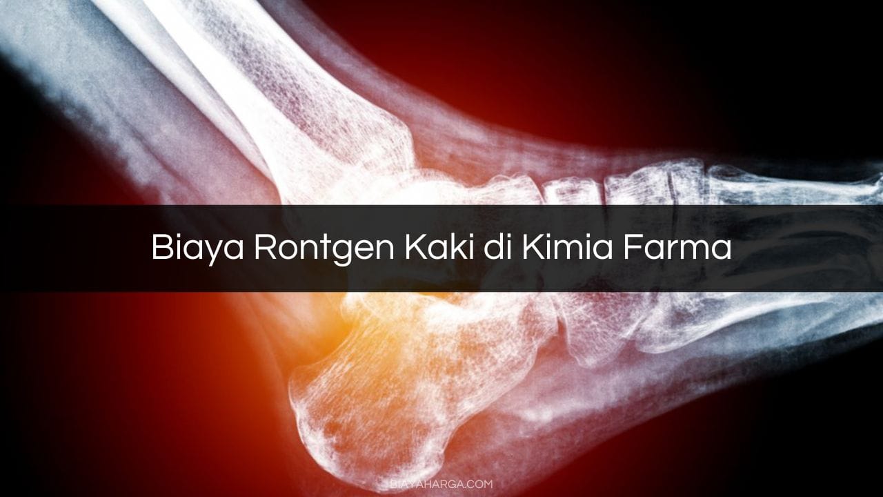 Biaya Rontgen Kaki di Kimia Farma