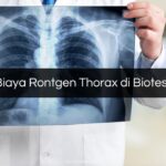 Biaya Rontgen Thorax di Biotest