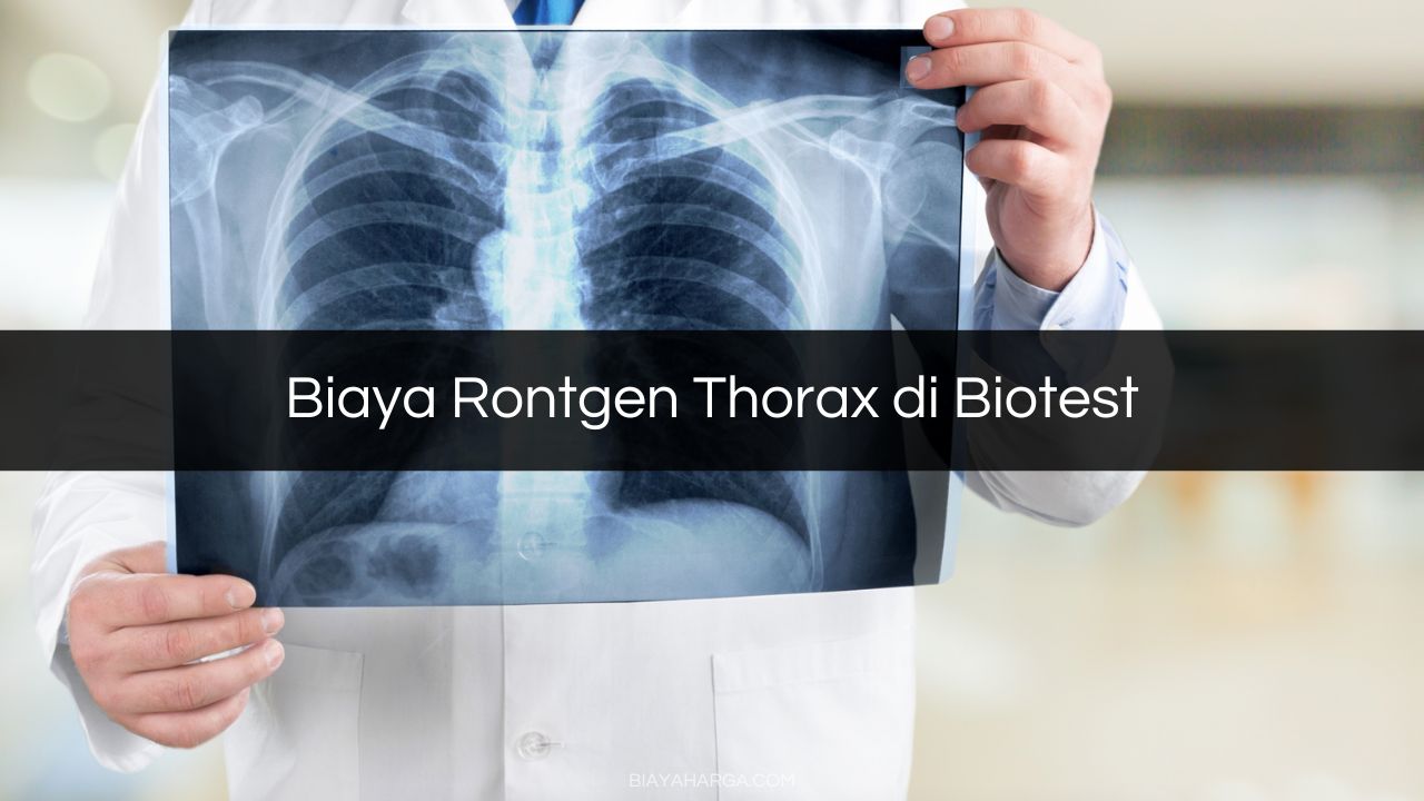 Biaya Rontgen Thorax di Biotest