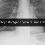 Biaya Rontgen Thorax di Sima Lab