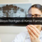 Biaya Rontgen di Kimia Farma