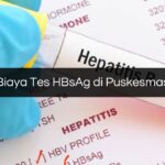 Biaya Tes HBsAg di Puskesmas