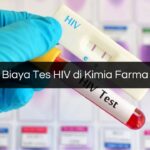 Biaya Tes HIV di Kimia Farma