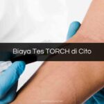 Biaya Tes TORCH di Cito