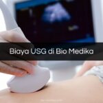 Biaya USG di Bio Medika