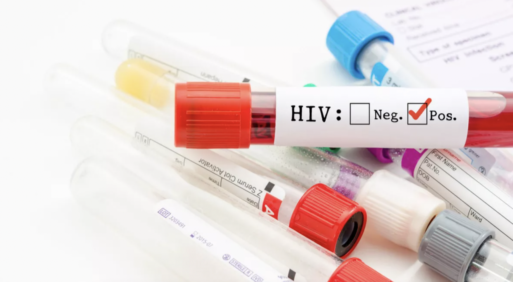 √ Biaya Tes HIV di Kimia Farma 2023 Prosedur & Risiko